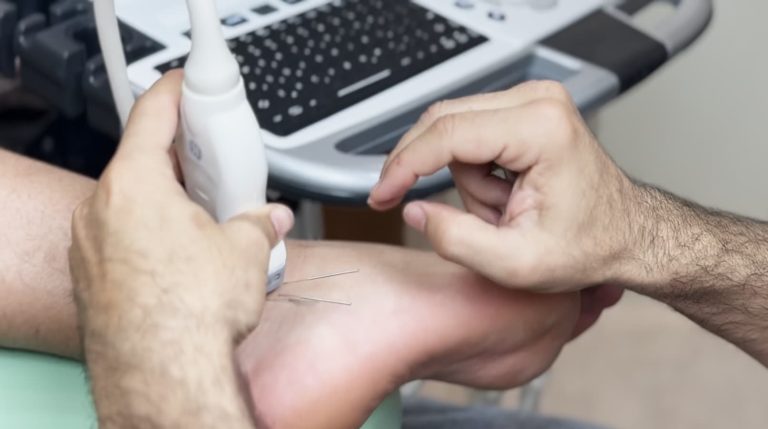 NEUROMODULACIÓN INVASIVA